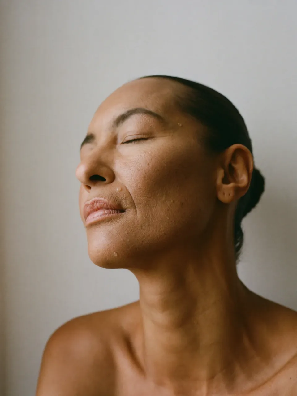 Mesoterapia Facial · Vitaminas + Ácido Hialurónico · edel.Clinic