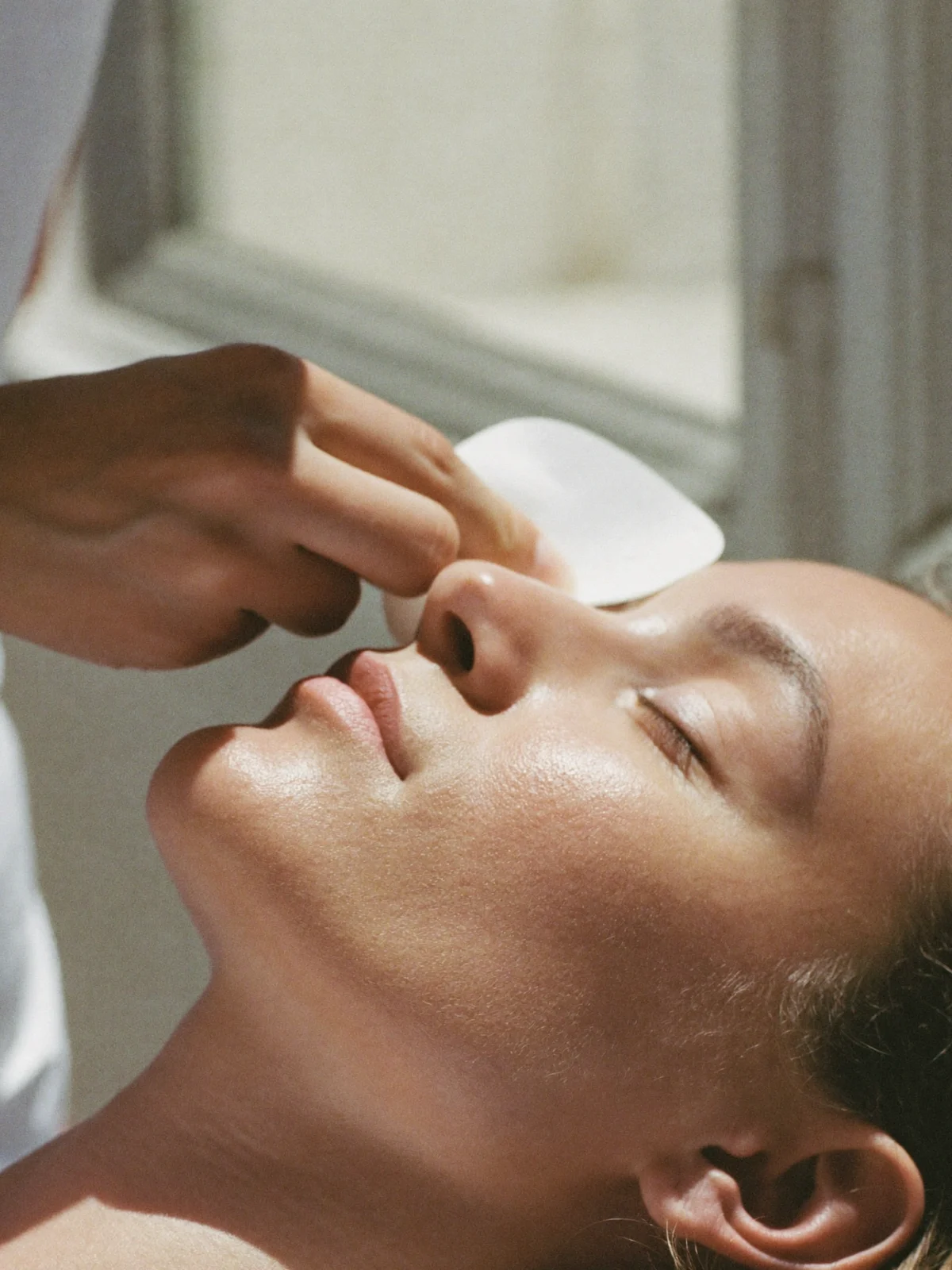 edel.clinic u2014 peeling quimico medico tca