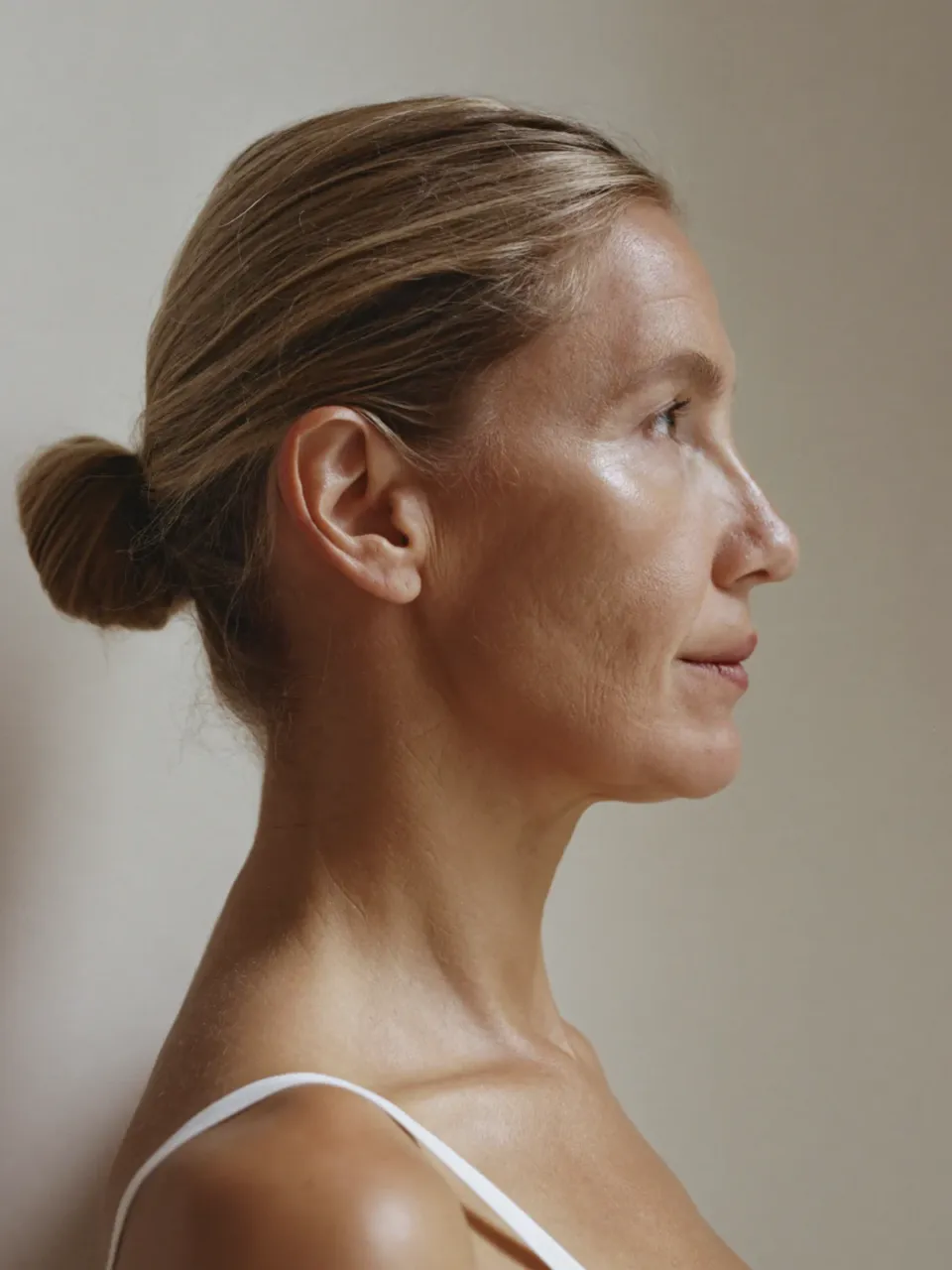 Radiofrecuencia Facial · edel.Clinic